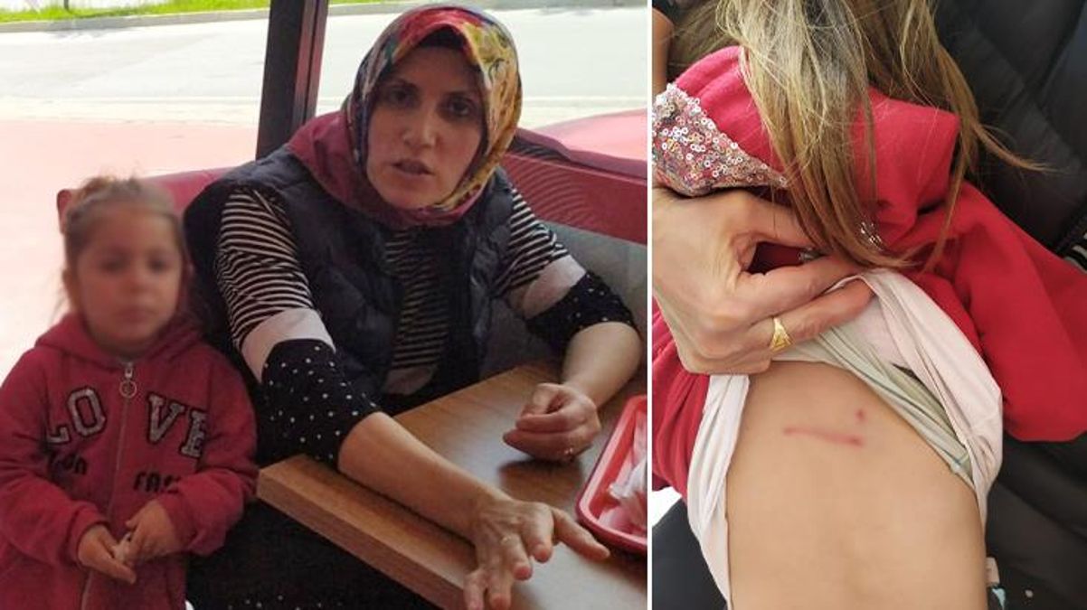 İzmit'te başıboş sokak köpekleri anne kıza saldırdı! Belediye liderine dava açacaklar