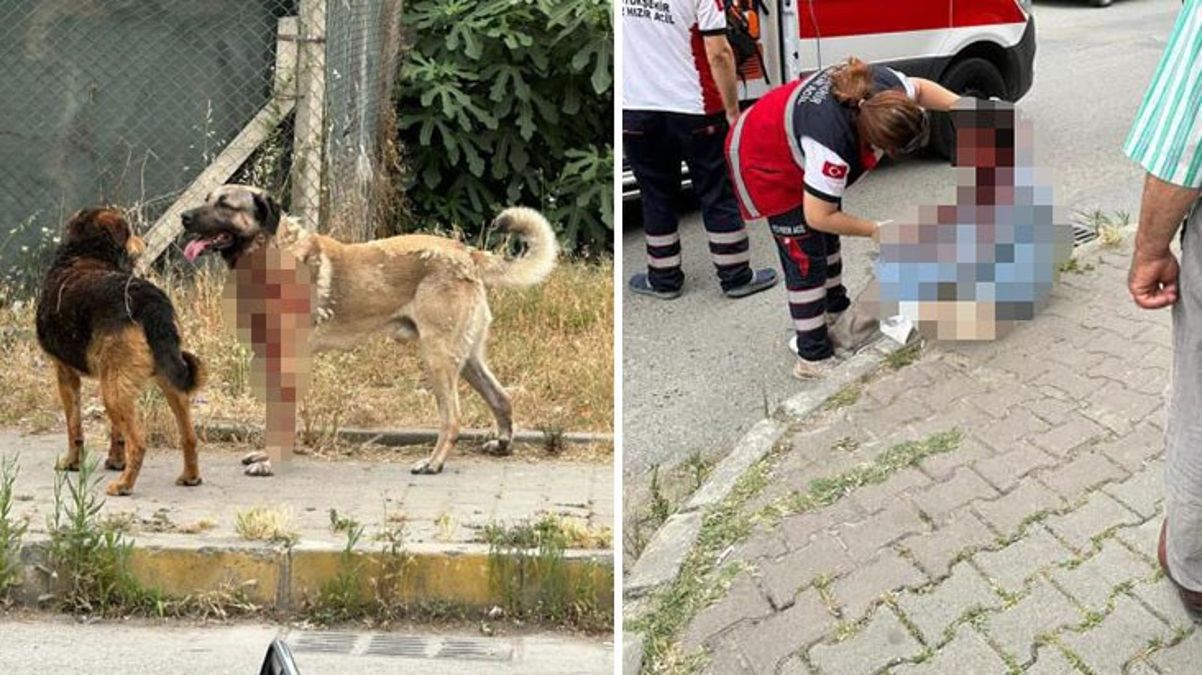 İstanbul'da köpek saldırısına uğrayan bayan gözünü kaybetti
