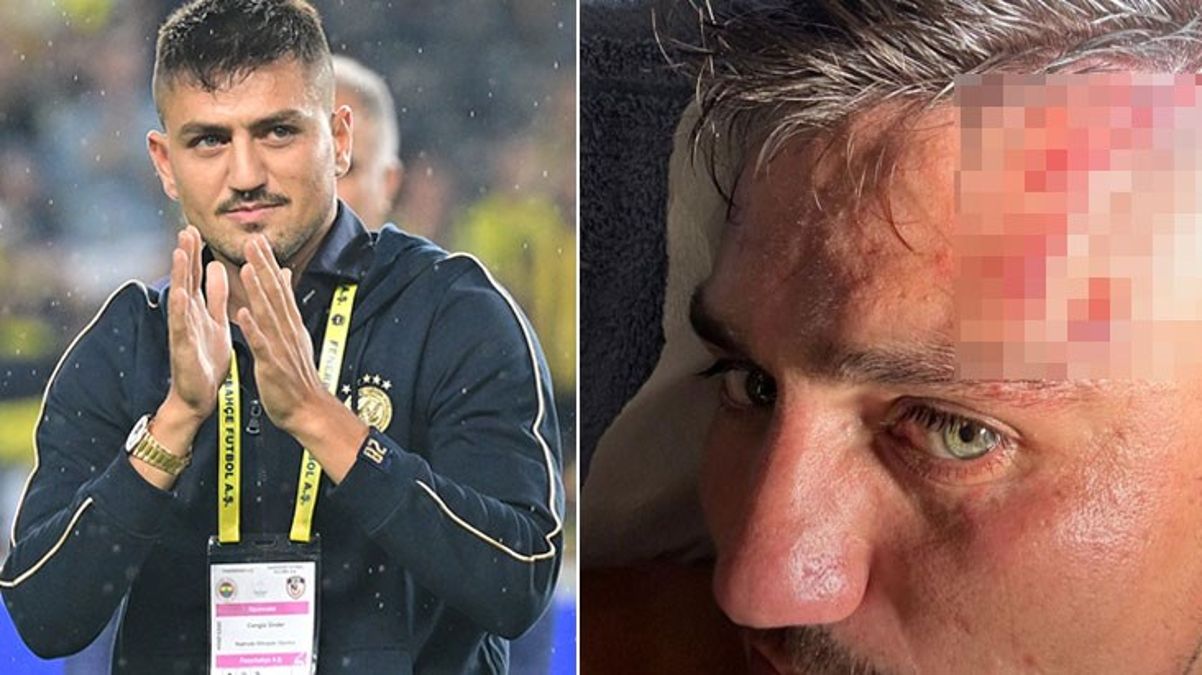 Fenerbahçe'nin yeni yıldızı Cengiz Ünder, kanlar içinde kaldı! Son halini paylaşıp, "Hoş bulduk" dedi